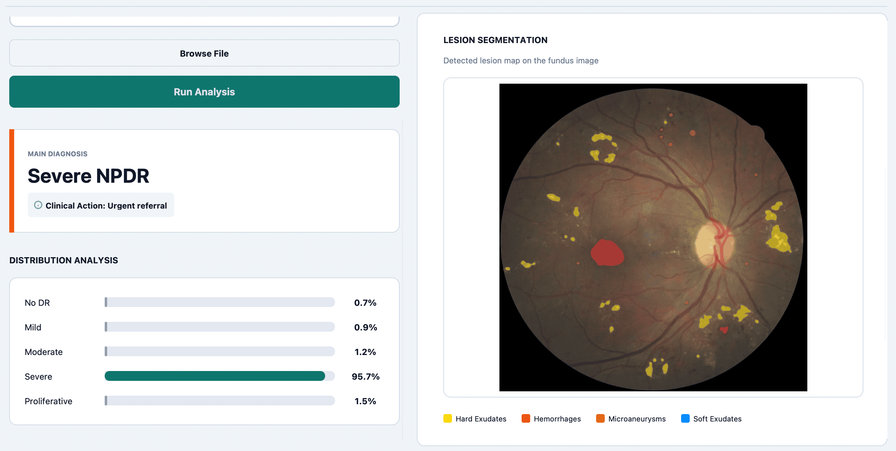 Lesion Segmentation